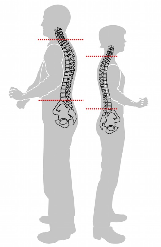 Rückenlänge siebter Wirbel Beckenknochen ausmessen